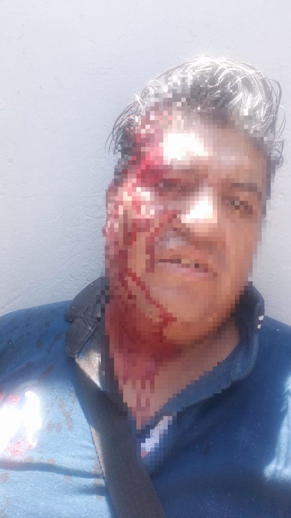 Golpean brutalmente a comerciantes antorchistas frente al Hospital de Ortopedia de Puebla