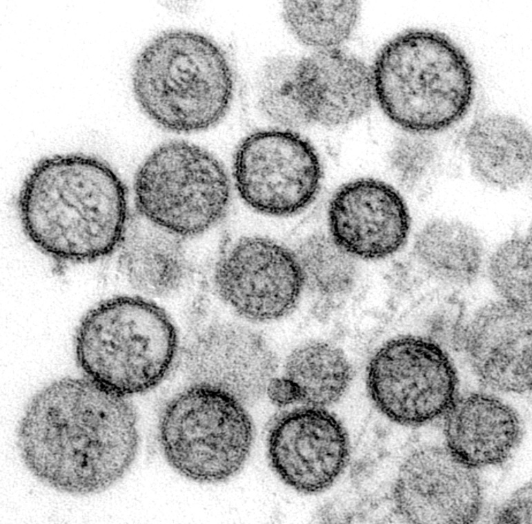 Presunto brote de hantavirus en crucero del Atlántico deja tres muertos